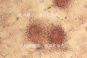 茜西红染色-骨细胞钙化结节.JPG