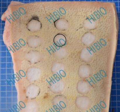 清创包有什么器械有源手术器械_https://www.jmylbn.com_新闻资讯_第2张