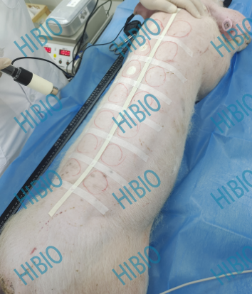 清创包有什么器械有源手术器械_https://www.jmylbn.com_新闻资讯_第3张