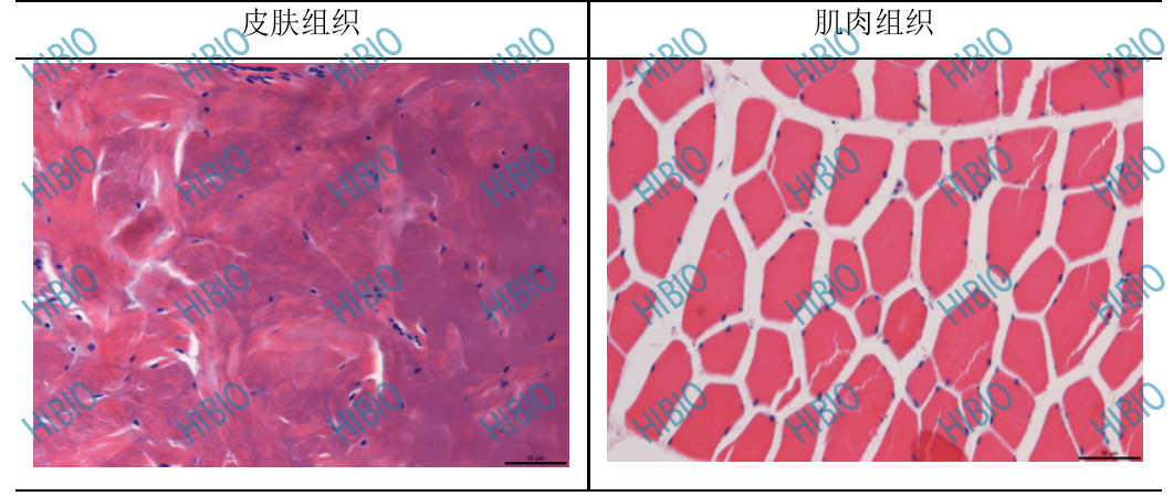 清创包有什么器械有源手术器械_https://www.jmylbn.com_新闻资讯_第4张