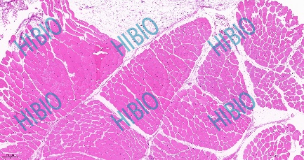 清创包有什么器械有源手术器械_https://www.jmylbn.com_新闻资讯_第5张