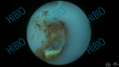 清创包有什么器械有源手术器械_https://www.jmylbn.com_新闻资讯_第6张