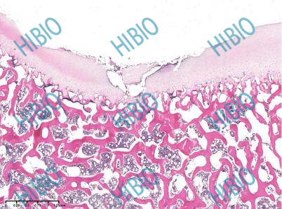 清创包有什么器械有源手术器械_https://www.jmylbn.com_新闻资讯_第7张